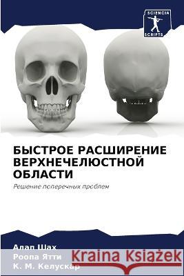 БЫСТРОЕ РАСШИРЕНИЕ ВЕРХ& Шах, Ал 9786205315415 Sciencia Scripts - książka