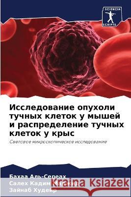 Исследование опухоли ту& Аль-Се
 Кадим 
 Худей 9786205713556 Sciencia Scripts - książka