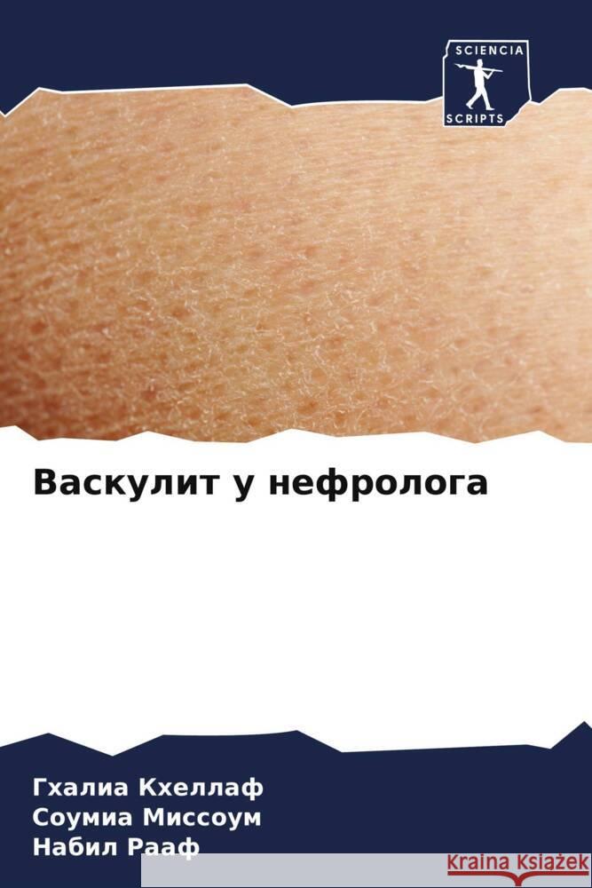 Васкулит у нефролога КХЕЛЛh МИССОi Н Рааф 9786206869474 Sciencia Scripts - książka