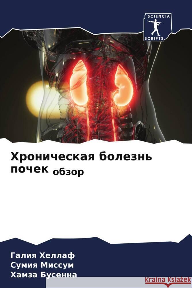 Хроническая болезнь поч& ХЕЛЛАj Миссуl Бусен 9786207390564 Sciencia Scripts - książka