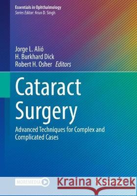  Cataract Surgery   9783030945329 Springer International Publishing - książka