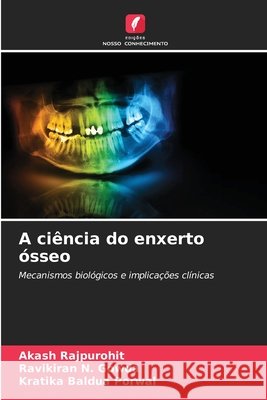 A ciência do enxerto ósseo Rajpurohit, Akash, N. Gowda, Ravikiran, Baldua Porwal, Kratika 9786208734428 Edições Nosso Conhecimento - książka