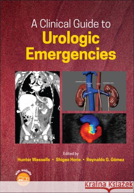 A Clinical Guide to Urologic Emergencies Hunter Wessells Shigeo Horie Shigeo Horie 9781119021476 Wiley-Blackwell - książka