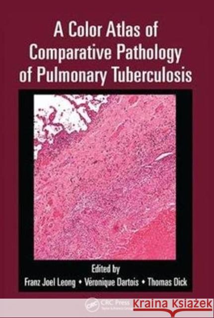 A Color Atlas of Comparative Pathology of Pulmonary Tuberculosis Franz Joel Leong 9781138451995 CRC Press - książka