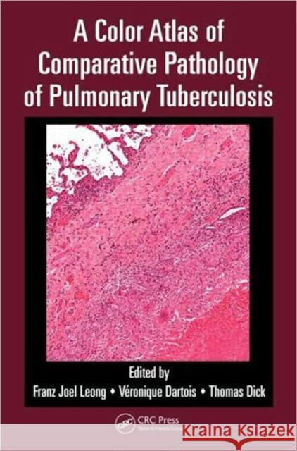 A Color Atlas of Comparative Pathology of Pulmonary Tuberculosis Franz Joel Leong Veronique Dartois Thomas Dick 9781439835272 Taylor and Francis - książka