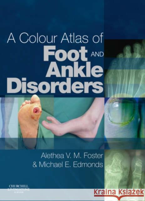 A Colour Atlas of Foot and Ankle Disorders Michael Edmonds 9780443102073  - książka