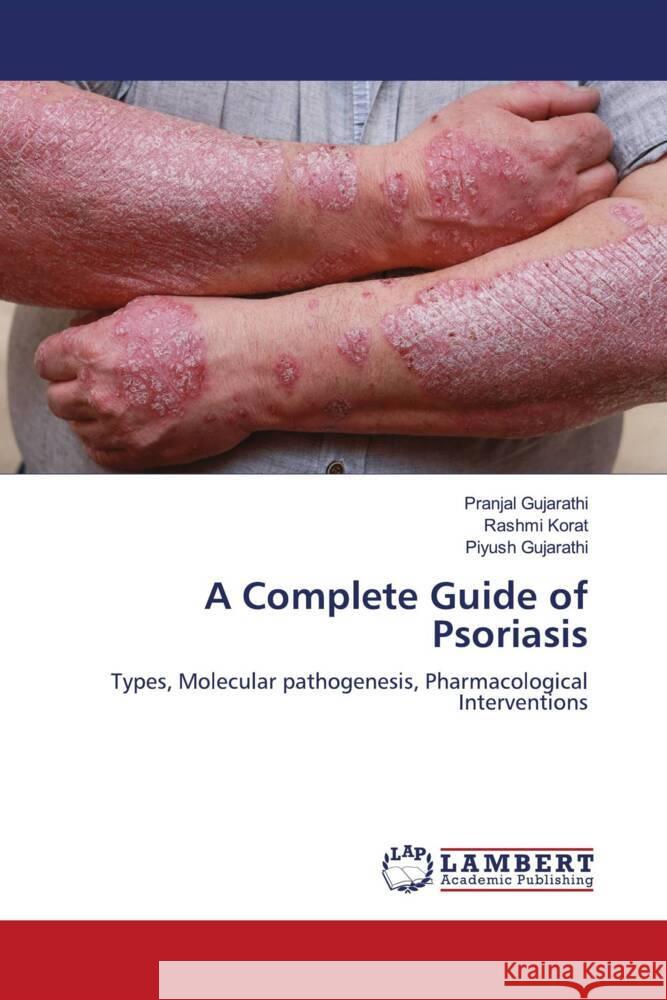 A Complete Guide of Psoriasis Gujarathi, Pranjal, Korat, Rashmi, Gujarathi, Piyush 9786206778714 LAP Lambert Academic Publishing - książka
