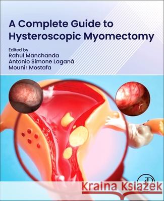 A Complete Guide to Hysteroscopic Myomectomy Rahul Manchanda Antonio Simone Lagan? Mounir Mostafa 9780443366703 Academic Press - książka