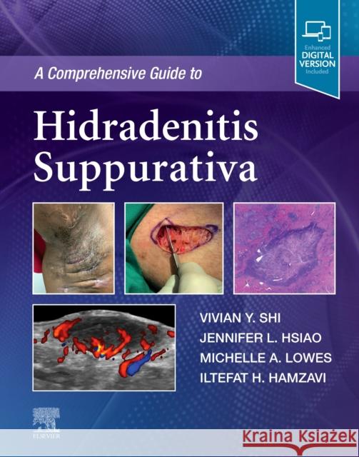 A Comprehensive Guide to Hidradenitis Suppurativa Vivian Y. Shi Jennifer L. Hsiao Michelle Lowes 9780323777247 Elsevier - książka