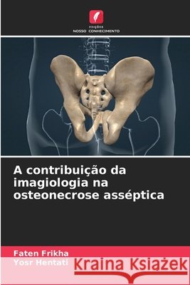 A contribuição da imagiologia na osteonecrose asséptica Frikha, Faten, Hentati, Yosr 9786202325417 Edições Nosso Conhecimento - książka