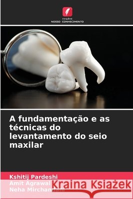 A fundamenta??o e as t?cnicas do levantamento do seio maxilar Kshitij Pardeshi Amit Agrawal Neha Mirchandani 9786209406874 Edicoes Nosso Conhecimento - książka