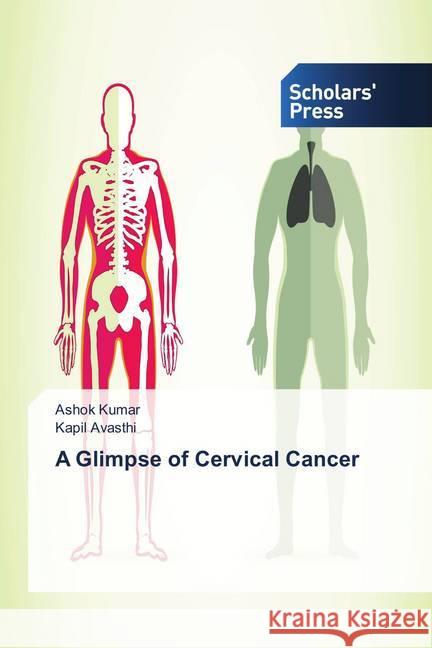 A Glimpse of Cervical Cancer Kumar, Ashok; Avasthi, Kapil 9786202313957 Scholar's Press - książka