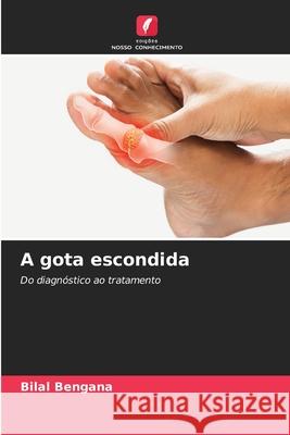 A gota escondida Bilal Bengana 9786207546558 Edicoes Nosso Conhecimento - książka