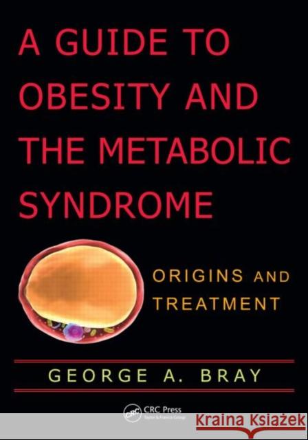 A Guide to Obesity and the Metabolic Syndrome: Origins and Treatment Bray, George A. 9781439814574 Taylor and Francis - książka