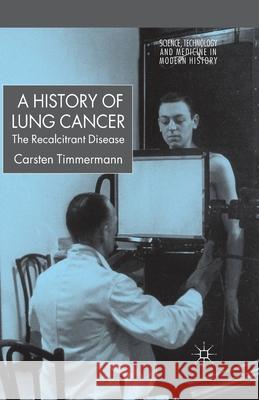 A History of Lung Cancer: The Recalcitrant Disease Timmermann, C. 9781349541874 Palgrave Macmillan - książka