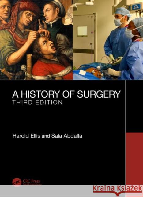 A History of Surgery: Third Edition Ellis, Harold 9781138617391 CRC Press - książka