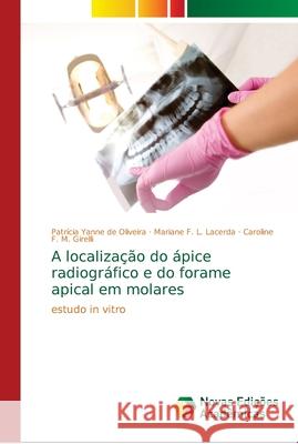 A localização do ápice radiográfico e do forame apical em molares de Oliveira, Patrícia Yanne 9786139650668 Novas Edicioes Academicas - książka