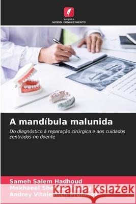 A mandíbula malunida Hadhoud, Sameh Salem, Mekhaeel, Mekhaeel Shehata Fakhry, Protasov, Andrey Vitalevitch 9786209257209 Edições Nosso Conhecimento - książka