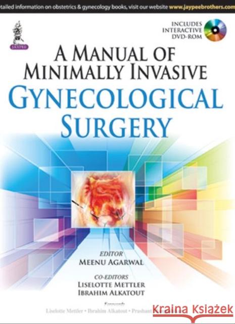 A Manual of Minimally Invasive Gynecological Surgery Liselotte Mettler Ibrahim Alkatout  9789351527664 Jaypee Brothers Medical Publishers - książka