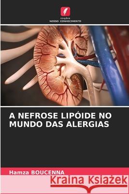 A Nefrose Lip?ide No Mundo Das Alergias Hamza Boucenna 9786207522637 Edicoes Nosso Conhecimento - książka