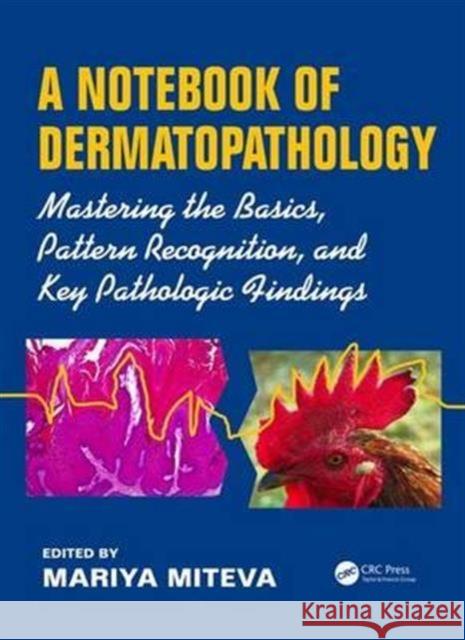 A Notebook of Dermatopathology: Mastering the Basics, Pattern Recognition, and Key Pathologic Findings Maria Miteva 9781482219579 CRC Press - książka