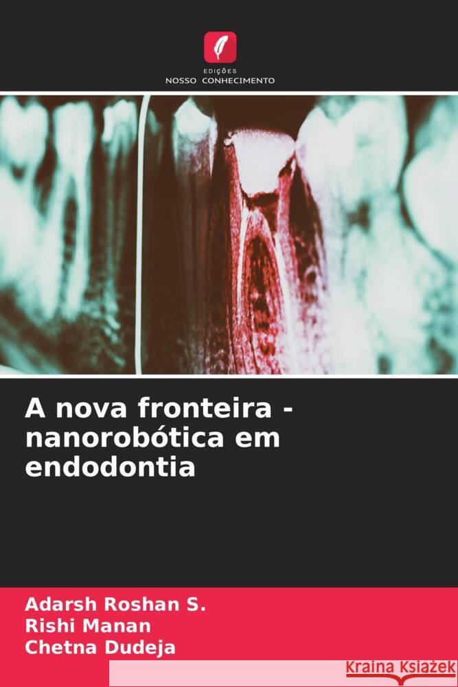 A nova fronteira - nanorobótica em endodontia Roshan S., Adarsh, Manan, Rishi, Dudeja, Chetna 9786206587392 Edições Nosso Conhecimento - książka