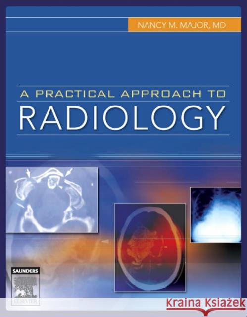 A Practical Approach to Radiology Nancy M. Major 9781416023418 W.B. Saunders Company - książka