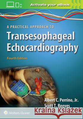 A Practical Approach to Transesophageal Echocardiography Albert C. Perrino Scott T. Reeves 9781496383471 LWW - książka