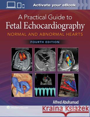 A Practical Guide to Fetal Echocardiography: Normal and Abnormal Hearts Alfred Z. Abuhamad Rabih Chaoui 9781975126810 Wolters Kluwer Health - książka