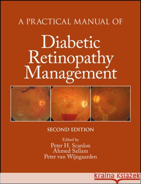 A Practical Manual of Diabetic Retinopathy Management Scanlon, Peter; Sallam, Ahmed 9781119058953 John Wiley & Sons - książka