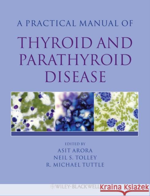 A Practical Manual of Thyroid and Parathyroid Disease Arora, Asit 9781405170345 Wiley-Blackwell - książka