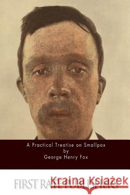A Practical Treatise on Smallpox George Henry Fox 9781514879757 Createspace - książka