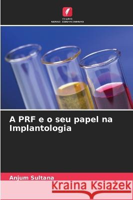 A PRF e o seu papel na Implantologia Anjum Sultana 9786205842850 Edicoes Nosso Conhecimento - książka