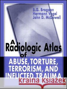 A Radiologic Atlas of Abuse, Torture, Terrorism, and Inflicted Trauma B. G. Brogdon Hermann Vogel John D. McDowell 9780849315336 CRC Press - książka