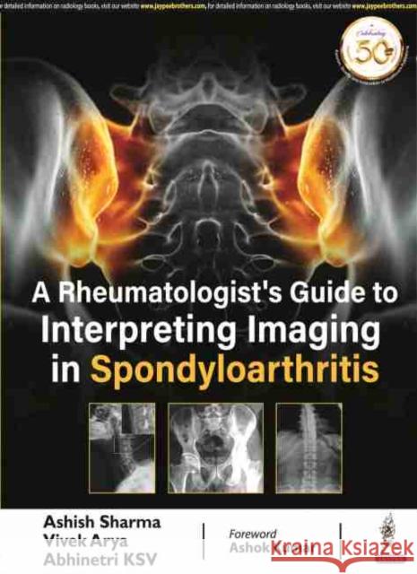 A Rheumatologist's Guide to Interpreting Imaging in Spondyloarthritis Ashish Sharma Vivek Arya Abhinetri KSV 9789389776959 Jaypee Brothers Medical Publishers - książka