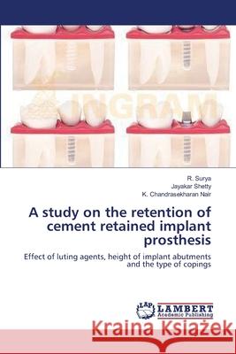 A study on the retention of cement retained implant prosthesis Surya, R. 9783659417207 LAP Lambert Academic Publishing - książka