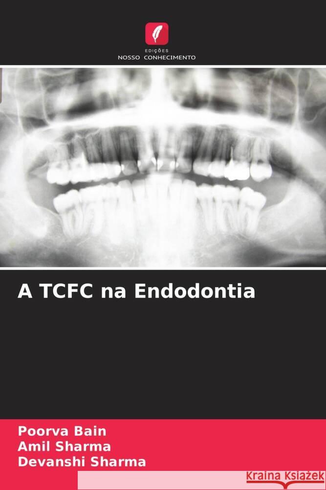 A TCFC na Endodontia Bain, Poorva, Sharma, Amil, Sharma, Devanshi 9786205156377 Edições Nosso Conhecimento - książka