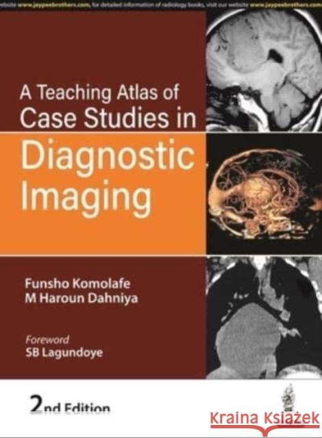 A Teaching Atlas of Case Studies in Diagnostic Imaging Funsho Komolafe M Haroun Dahniya  9789354656743 Jaypee Brothers Medical Publishers - książka