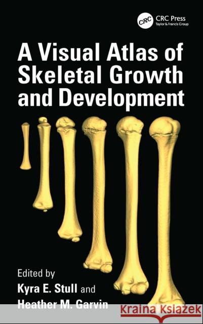 A Visual Atlas of Skeletal Growth and Development  9781032754857 Taylor & Francis Ltd - książka