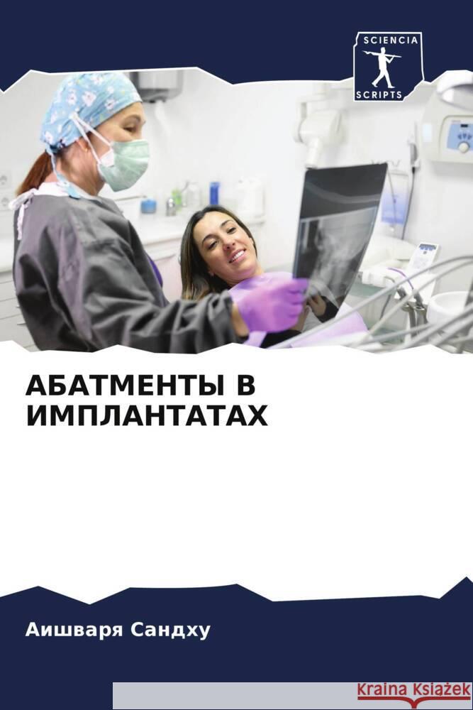 ABATMENTY V IMPLANTATAH Sandhu, Aishwarq 9786208221164 Sciencia Scripts - książka