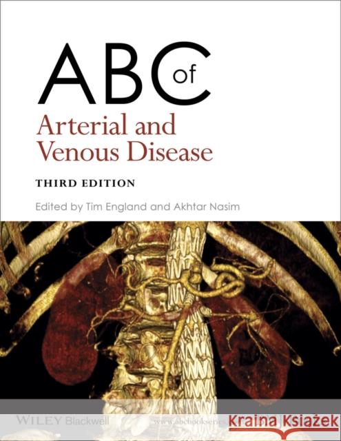 ABC of Arterial and Venous Disease  9781118740682 John Wiley & Sons - książka