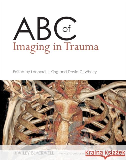 ABC of Imaging in Trauma  King 9781405183321  - książka