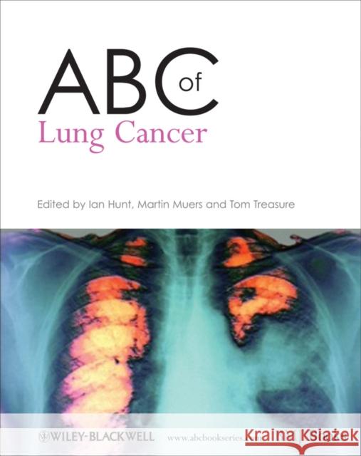 ABC of Lung Cancer Ian Hunt Tom Treasure Martin Muers 9781405146524 Blackwell Publishers - książka