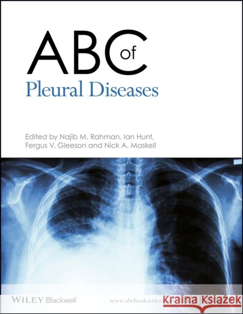 ABC of Pleural Diseases Ian Hunt Nick Maskell Fergus Gleeson 9780470654743  - książka