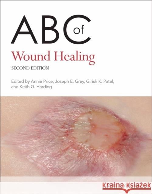 ABC of Wound Healing Grey, Joseph E.; Harding, Keith G.; Patel, Girish 9780470658970 John Wiley & Sons Inc - książka