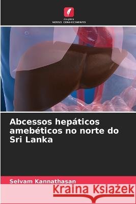 Abcessos hepáticos amebéticos no norte do Sri Lanka Kannathasan, Selvam 9786205292891 Edicoes Nosso Conhecimento - książka