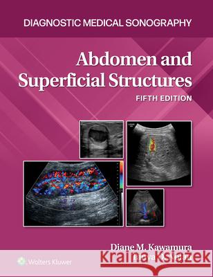 Abdomen and Superficial Structures Diane Kawamura 9781975174972 Wolters Kluwer Health - książka
