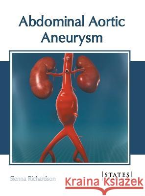 Abdominal Aortic Aneurysm Sienna Richardson 9781639890118 States Academic Press - książka