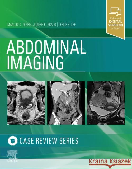 Abdominal Imaging: Case Review Series Manjiri Dighe Joseph R. Grajo Leslie Lee 9780323679848 Elsevier - książka