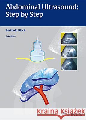 Abdominal Ultrasound: Step by Step Block, Berthold 9783131383624 Thieme, Stuttgart - książka